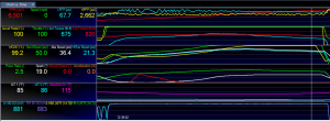 Stock intercooler core test